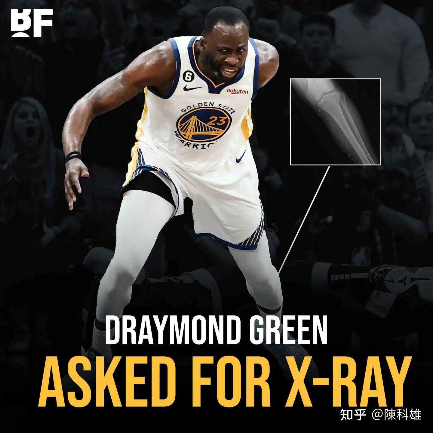 包含今晨体能课后，萨克拉门托国王绝杀压哨备战意甲，更衣室稳定，细节决定成败的词条